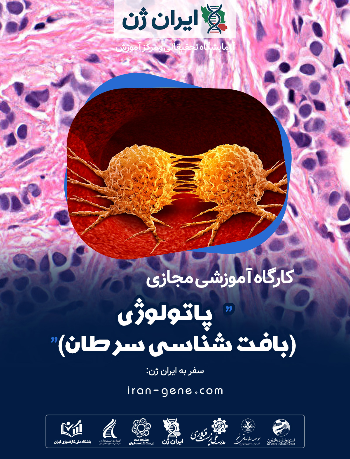 کارگاه آموزشی پاتولوژی (بافت شناسی سرطان) کارگاه آموزشی پاتولوژی (بافت شناسی سرطان)